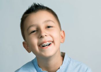 Брекеты для детей