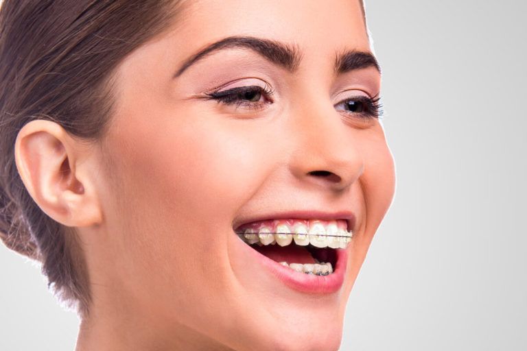 Исправление прикуса у взрослых