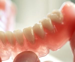 Съемное протезирование зубов