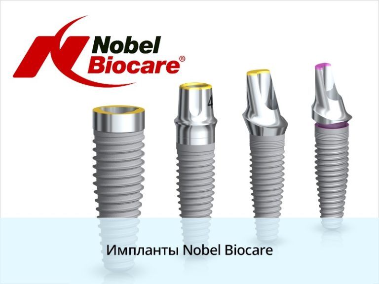 Имплантация зубов с помощью имплантатов Nobel Biocare