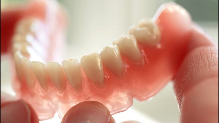 Съемное протезирование зубов