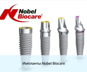 Имплантация зубов с помощью имплантатов Nobel Biocare