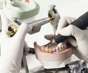 Изготовление бюгельного протеза