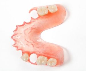 Зубные нейлоновые протезы