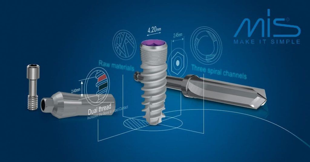 Имплантация зубов с помощью имплантатов MIS