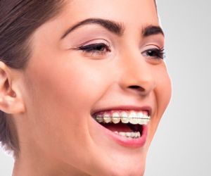 Исправление прикуса у взрослых